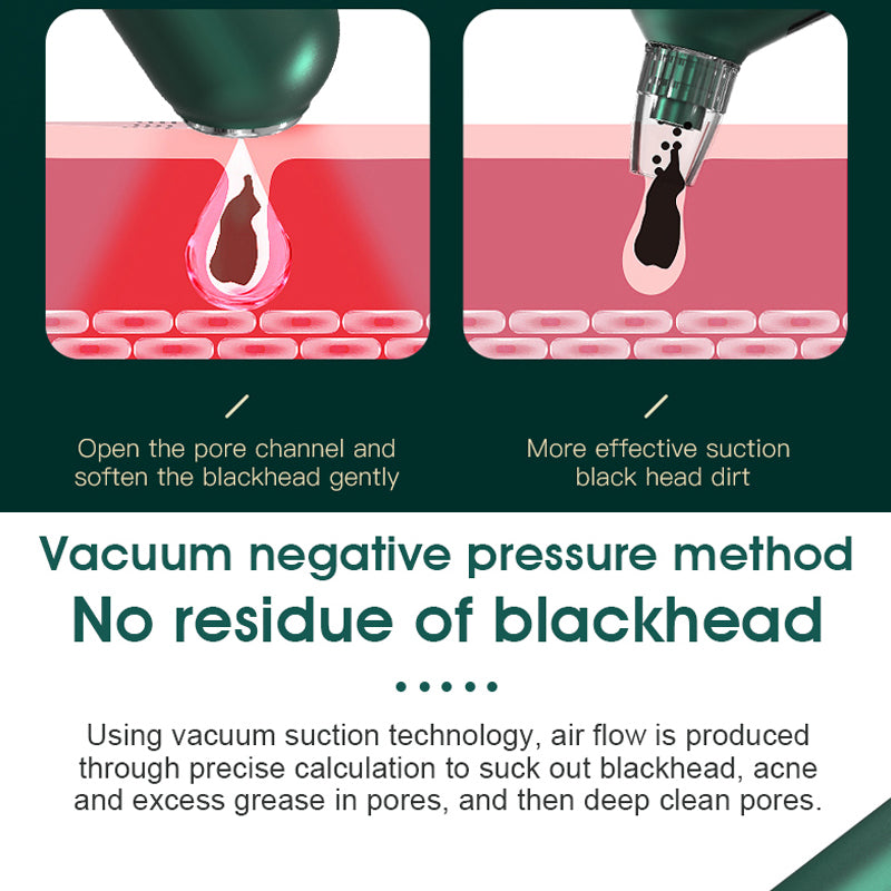 ClearGlo Blackhead Remover