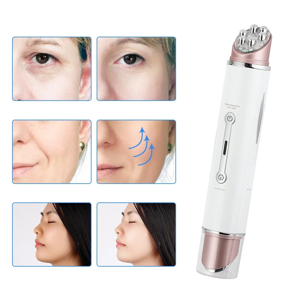 EyeRevive Beauty Device